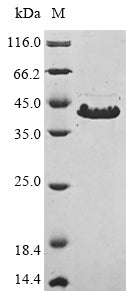 (Tris-Glycine gel) Discontinuous SDS-PAGE (reduced) with 5% enrichment gel and 15% separation gel.