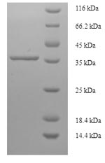 Recombinant Human PDZ and LIM domain protein 3 (PDLIM3) – Figure 1 of 1
