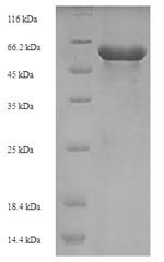 Recombinant Staphylococcus aureus 3-oxoacyl-[acyl-carrier-protein] synthase 2 (fabF) – Figure 1 of 1