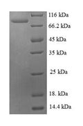 Recombinant Streptomyces sp. Cholesterol oxidase (choA) – Figure 1 of 1