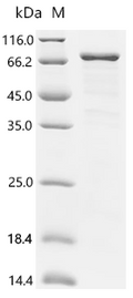 (Tris-Glycine gel) Discontinuous SDS-PAGE (reduced) with 5% enrichment gel and 15% separation gel.