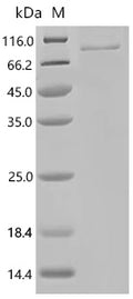 Recombinant Human Polyadenylate-binding protein 1-like (PABPC1L) – Figure 1 of 1