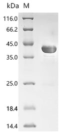 (Tris-Glycine gel) Discontinuous SDS-PAGE (reduced) with 5% enrichment gel and 15% separation gel.
