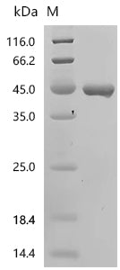 (Tris-Glycine gel) Discontinuous SDS-PAGE (reduced) with 5% enrichment gel and 15% separation gel.