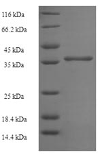 Recombinant Human Uncharacterized protein C11orf73 (C11orf73) – Figure 1 of 1
