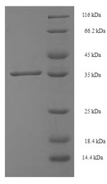 Recombinant Human Single-strand selective monofunctional uracil DNA glycosylase (SMUG1) – Figure 1 of 1