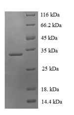 Recombinant Human PDZ domain-containing protein 11 (PDZD11) – Figure 1 of 1
