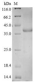 (Tris-Glycine gel) Discontinuous SDS-PAGE (reduced) with 5% enrichment gel and 15% separation gel.