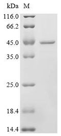 (Tris-Glycine gel) Discontinuous SDS-PAGE (reduced) with 5% enrichment gel and 15% separation gel.