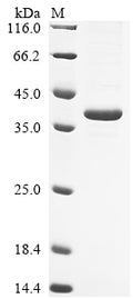 (Tris-Glycine gel) Discontinuous SDS-PAGE (reduced) with 5% enrichment gel and 15% separation gel.