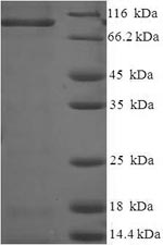 Recombinant Rat Caprin-1 (Caprin1) – Figure 1 of 1