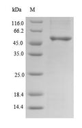 Recombinant Human Clavesin-2 (CLVS2) – Figure 1 of 1