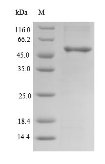 Recombinant Human Clavesin-2 (CLVS2) – Figure 1 of 1