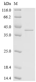 (Tris-Glycine gel) Discontinuous SDS-PAGE (reduced) with 5% enrichment gel and 15% separation gel.