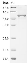 (Tris-Glycine gel) Discontinuous SDS-PAGE (reduced) with 5% enrichment gel and 15% separation gel.