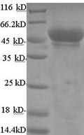 Recombinant Mouse Hydroxyacyl-coenzyme A dehydrogenase, mitochondrial (Hadh) – Figure 1 of 1