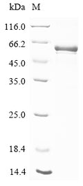 (Tris-Glycine gel) Discontinuous SDS-PAGE (reduced) with 5% enrichment gel and 15% separation gel.