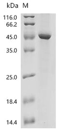 (Tris-Glycine gel) Discontinuous SDS-PAGE (reduced) with 5% enrichment gel and 15% separation gel.