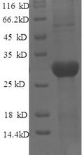 Recombinant Mouse Tyrosine-protein kinase JAK3 (Jak3), partial – Figure 1 of 1