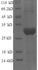 Recombinant Mouse Tyrosine-protein kinase JAK3 (Jak3), partial – Figure 1 of 1