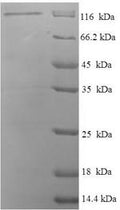 Recombinant Rat Disks large homolog 3 (Dlg3) – Figure 1 of 1