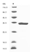 (Tris-Glycine gel) Discontinuous SDS-PAGE (reduced) with 5% enrichment gel and 15% separation gel.