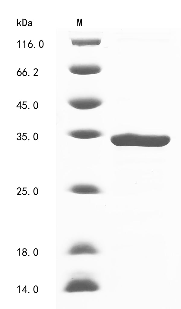 (Tris-Glycine gel) Discontinuous SDS-PAGE (reduced) with 5% enrichment gel and 15% separation gel.