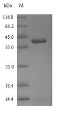(Tris-Glycine gel) Discontinuous SDS-PAGE (reduced) with 5% enrichment gel and 15% separation gel.