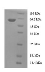 Recombinant Human Tubulin-specific chaperone cofactor E-like protein (TBCEL) – Figure 1 of 1