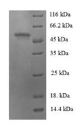Recombinant Human Na (+)/H (+) exchange regulatory cofactor NHE-RF3 (PDZK1) – Figure 1 of 1