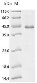 (Tris-Glycine gel) Discontinuous SDS-PAGE (reduced) with 5% enrichment gel and 15% separation gel.