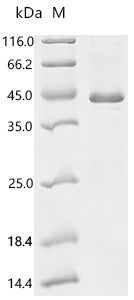 (Tris-Glycine gel) Discontinuous SDS-PAGE (reduced) with 5% enrichment gel and 15% separation gel.