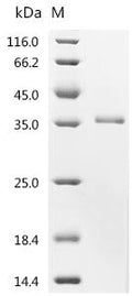 (Tris-Glycine gel) Discontinuous SDS-PAGE (reduced) with 5% enrichment gel and 15% separation gel.