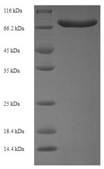 Recombinant Human Acyl-CoA-binding domain-containing protein 5 (ACBD5), partial – Figure 1 of 1
