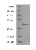 Recombinant Human Nucleoredoxin-like protein 2 (NXNL2) – Figure 1 of 1