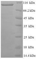 Recombinant Human Protein FAM160B1 (FAM160B1) – Figure 1 of 1