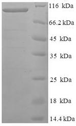 Recombinant Human Protein FAM160B1 (FAM160B1) – Figure 1 of 1