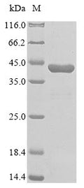 (Tris-Glycine gel) Discontinuous SDS-PAGE (reduced) with 5% enrichment gel and 15% separation gel.