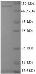 Recombinant Hepatitis E virus genotype 1 Secreted protein ORF2 (ORF2), partial – Figure 1 of 1