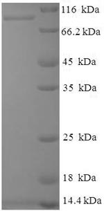 Recombinant Hepatitis E virus genotype 1 Secreted protein ORF2 (ORF2), partial – Figure 1 of 1