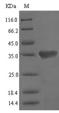 (Tris-Glycine gel) Discontinuous SDS-PAGE (reduced) with 5% enrichment gel and 15% separation gel.