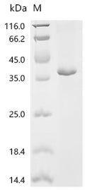 (Tris-Glycine gel) Discontinuous SDS-PAGE (reduced) with 5% enrichment gel and 15% separation gel.