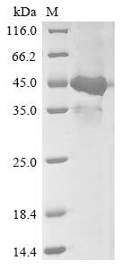 (Tris-Glycine gel) Discontinuous SDS-PAGE (reduced) with 5% enrichment gel and 15% separation gel.
