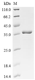 (Tris-Glycine gel) Discontinuous SDS-PAGE (reduced) with 5% enrichment gel and 15% separation gel.