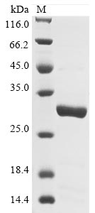 (Tris-Glycine gel) Discontinuous SDS-PAGE (reduced) with 5% enrichment gel and 15% separation gel.