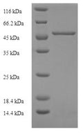 Recombinant Human Kidney mitochondrial carrier protein 1 (SLC25A30) – Figure 1 of 1