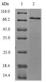 Recombinant Mouse E3 ubiquitin-protein ligase TRIM21 (Trim21) – Figure 1 of 1