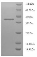 Recombinant Human La-related protein 1B (LARP1B) – Figure 1 of 1
