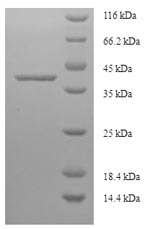 Recombinant Human La-related protein 1B (LARP1B) – Figure 1 of 1