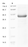 (Tris-Glycine gel) Discontinuous SDS-PAGE (reduced) with 5% enrichment gel and 15% separation gel.